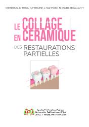 LE COLLAGE DES RESTAURATIONS PARTIELLES EN CERAMIQUE