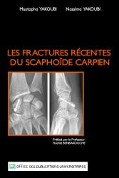 Les fractures récentes du Scaphoïde Carpien