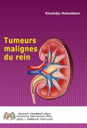 Tumeurs malignes du rein