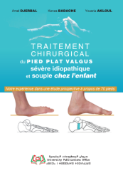 Traitement chirurgical du pied plat valgus sévère idiopathique et souple chez l’enfant