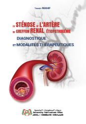 LA STÉNOSE DE L’ARTÈRE DU GREFFON RENAL ÉTIOPATHOGÉNIE, DIAGNOSTIC ET MODALITÉS THÉRAPEUTIQUES