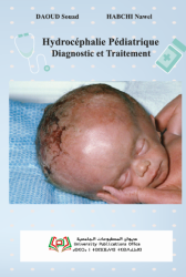 Hydrocéphalie Pédiatrique Diagnostic et Traitement