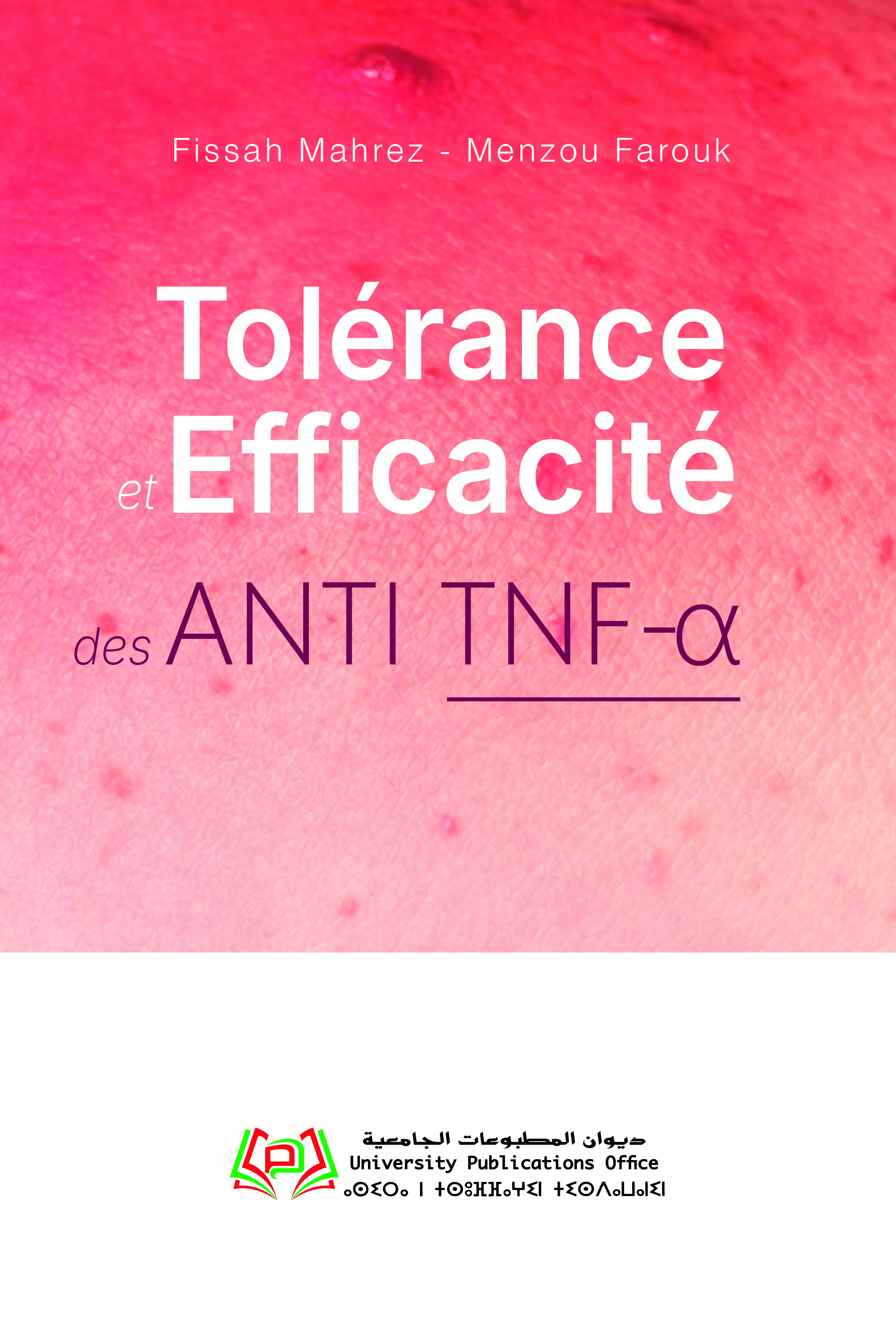 tolérance et efficacité des ANTI TNF