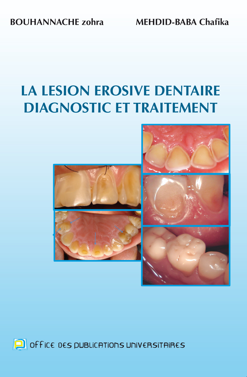 La lésion érosive dentaire diagnostic et traitement