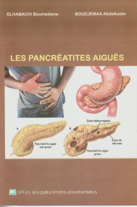 Les Pancréatites Aigues