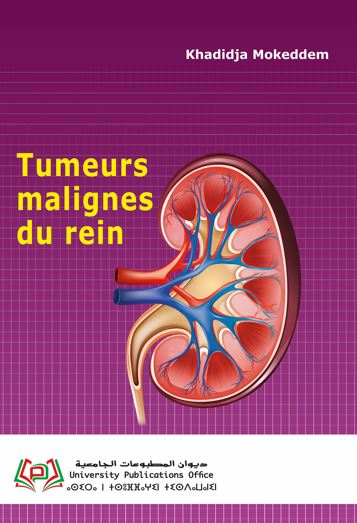 Tumeurs malignes du rein