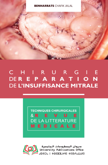 CHIRURGIE DE REPARATION DE L’INSUFFISANCE MITRALE / TECHNIQUES CHIRURGICALES ET REVUE DE LA LITTERATURE MEDICALE