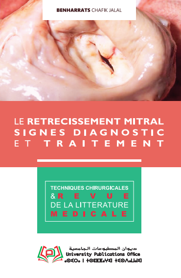LE RETRECISSEMENT MITRAL SIGNES DIAGNOSTIC ET TRAITEMENT / REVUE DE LA LITTERATURE MEDICALE