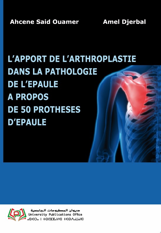 L’APPORT DE L’ARTHROPLASTIE DANS LA PATHOLOGIE DE L’EPAULE A PROPOS DE 50 PROTHESES D’EPAULE
