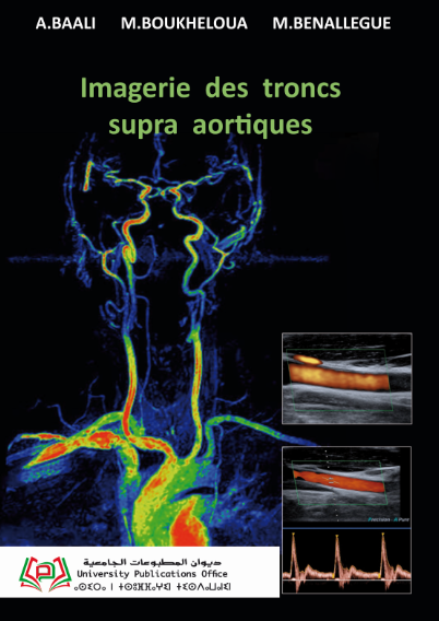 Imagerie des troncs supra aortiques