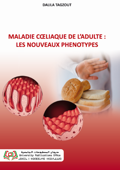 Maladie cœliaque de l’adulte : les nouveaux phénotypes
