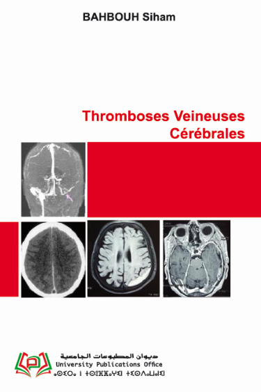 Thromboses Veineuses Cérébrales
