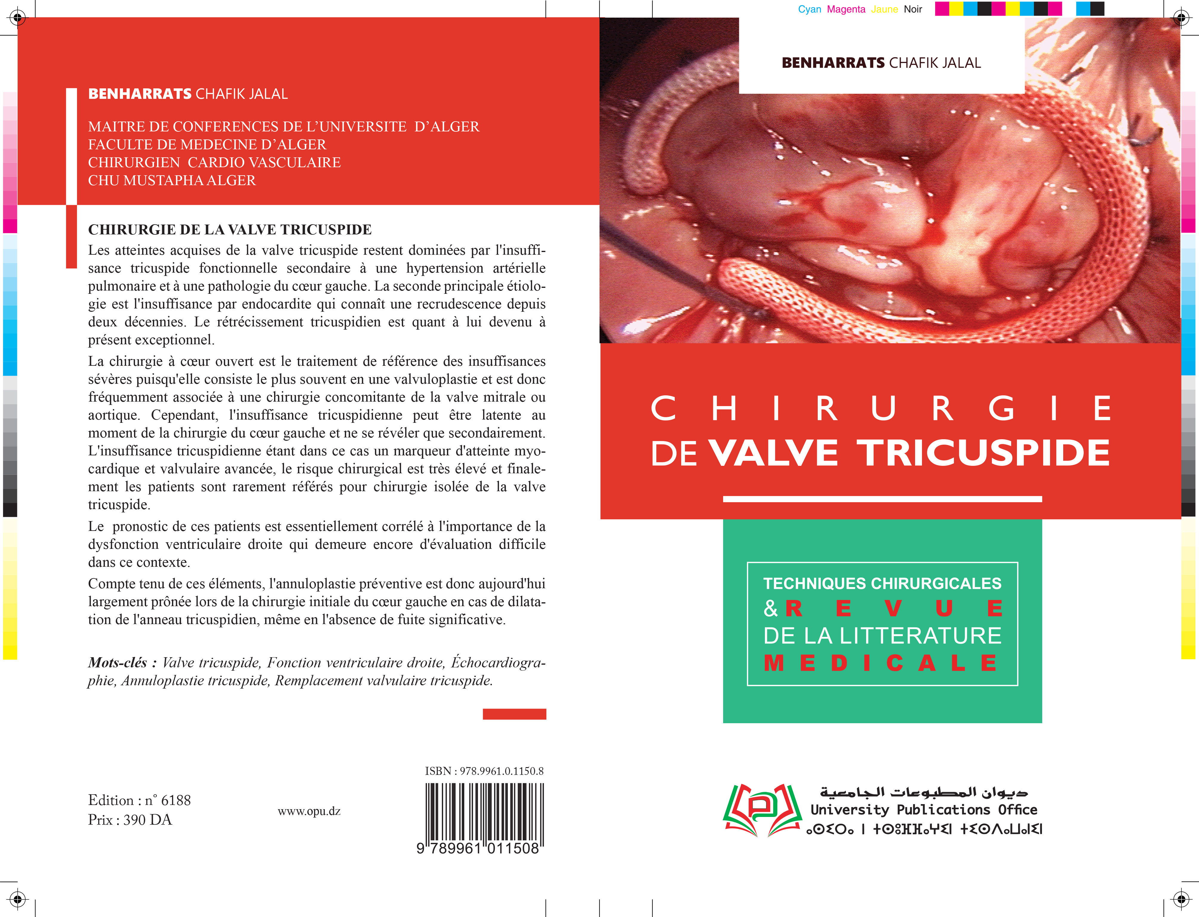 Chirurgie de la valve tricuspide diagnostic et traitement de l’insuffisance tricuspide
