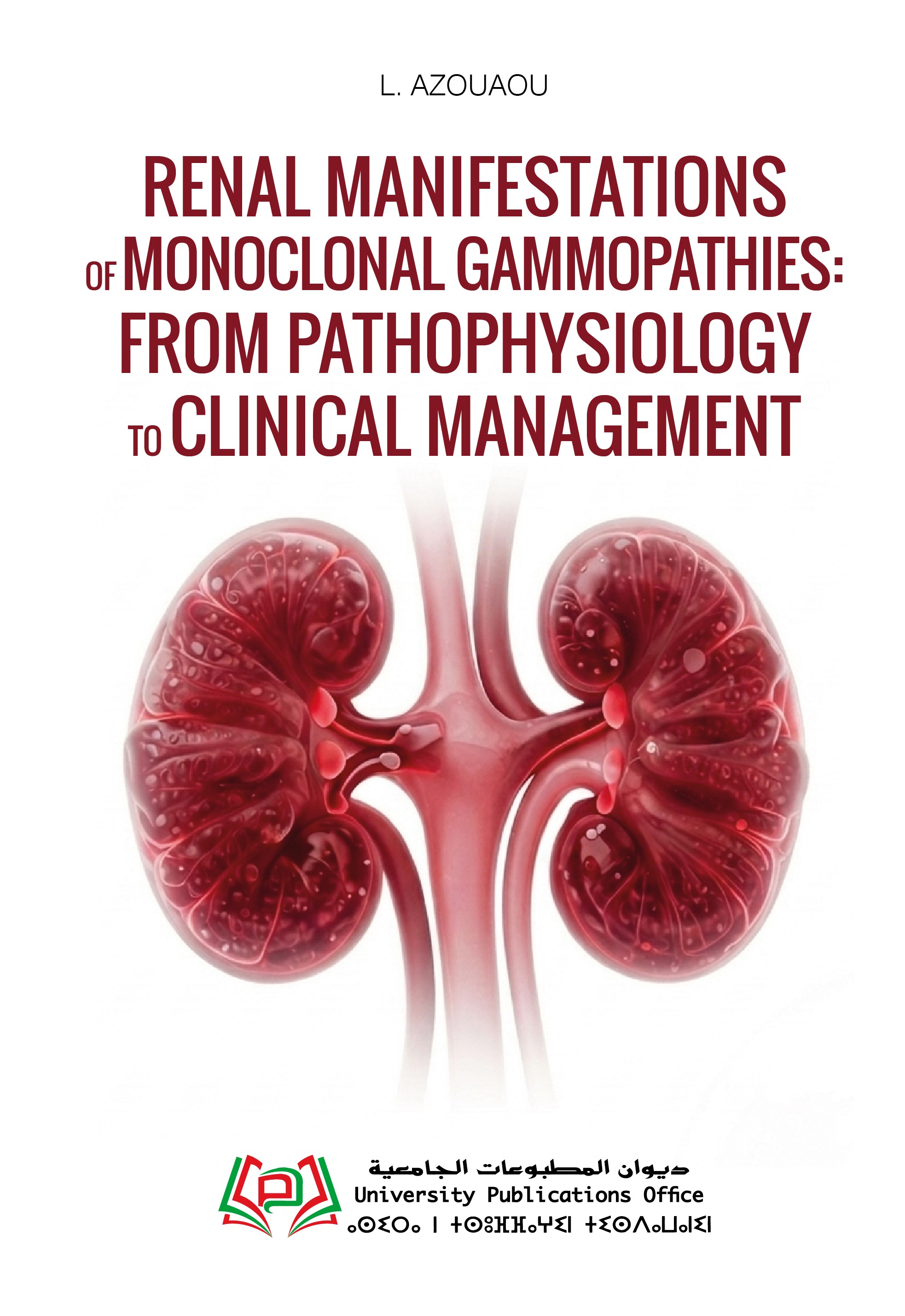 Renal Manifestations of Monoclonal Gammopathies: From Pathophysiology to Clinical Management