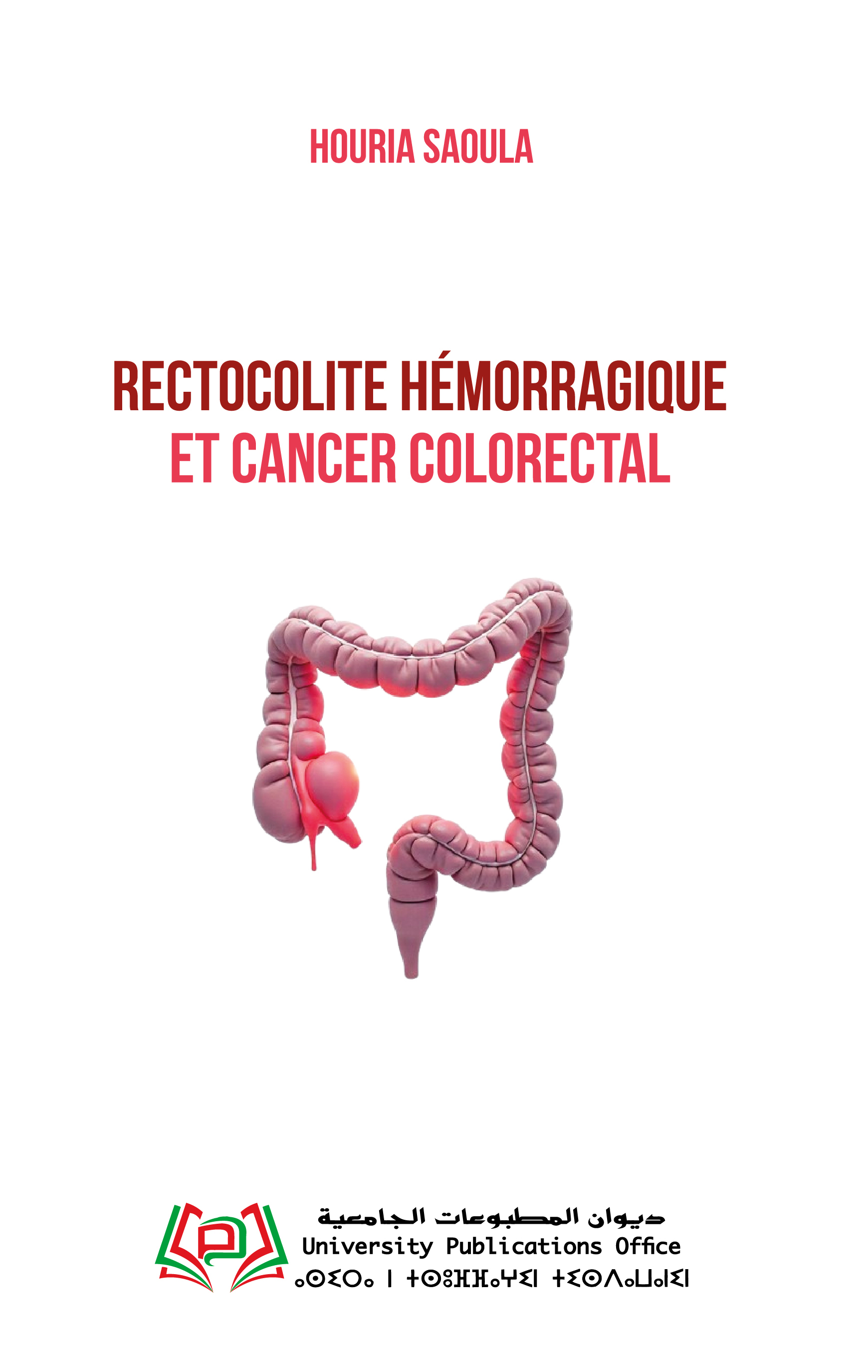 Rectocolite hémorragique et cancer colorectal